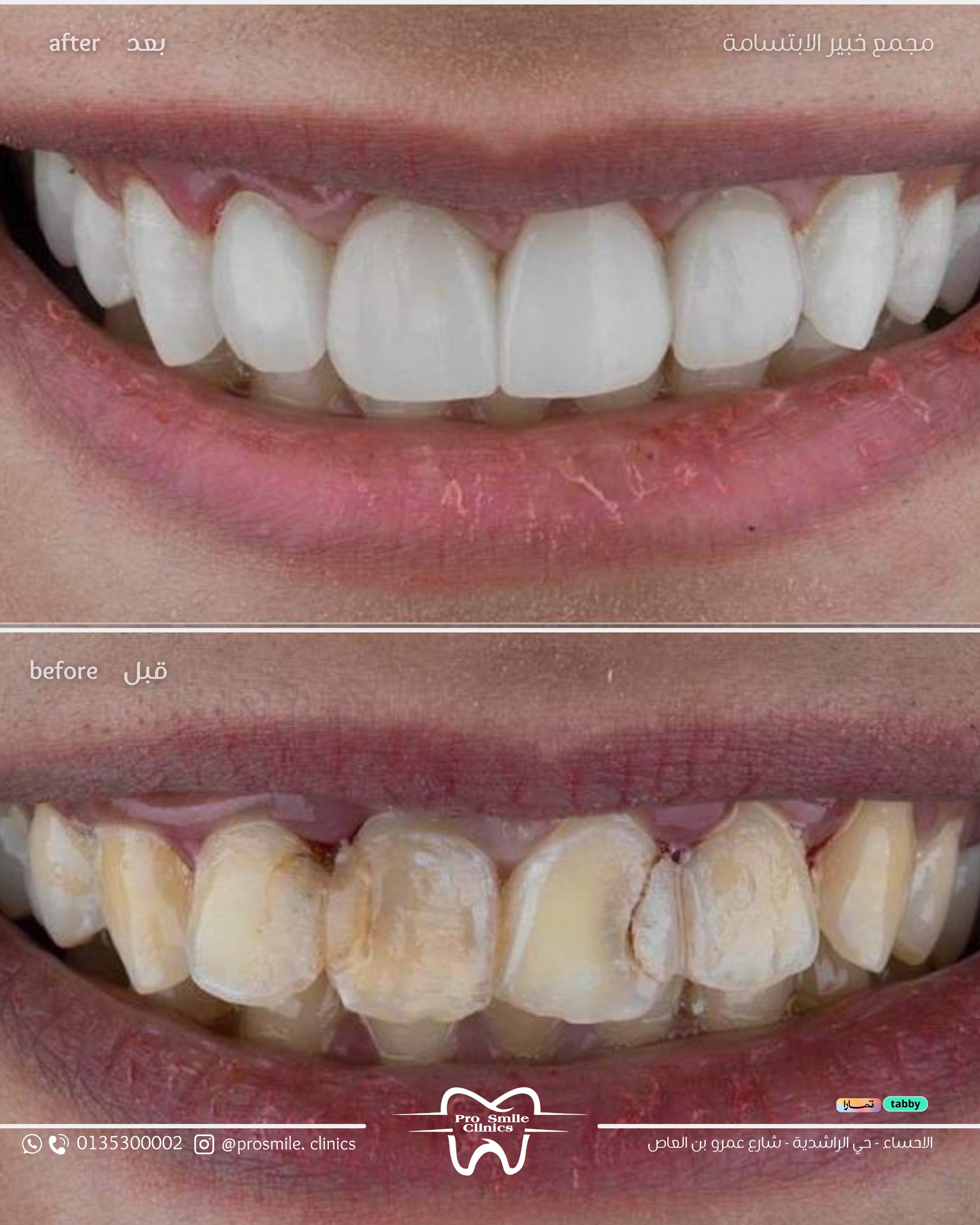 before after 5
